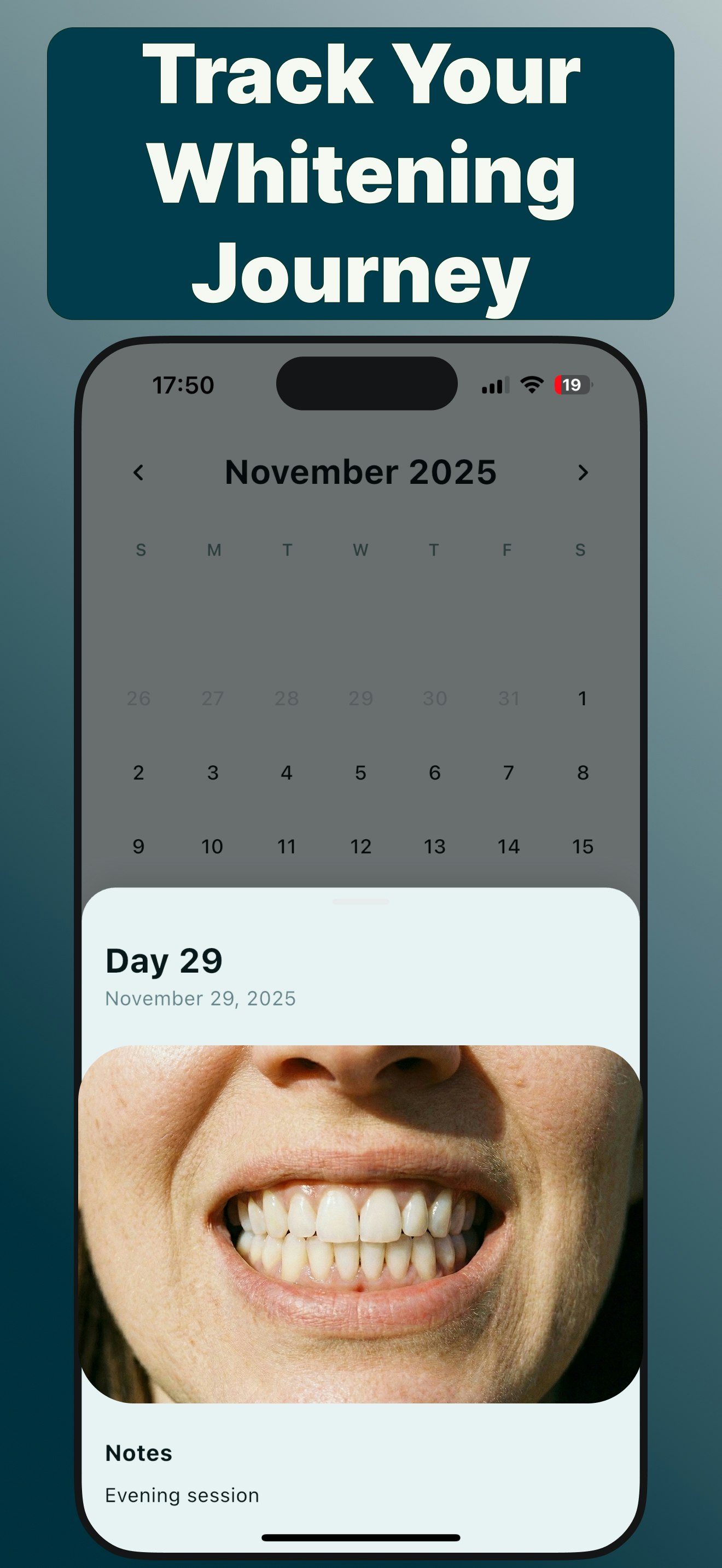 Mintora: Teeth Brush Routine & Reminder screenshot 4